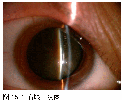 ZY016_74_2.gif